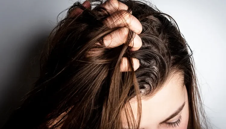 Мазна коса - Причини и начини да се справите с проблема
