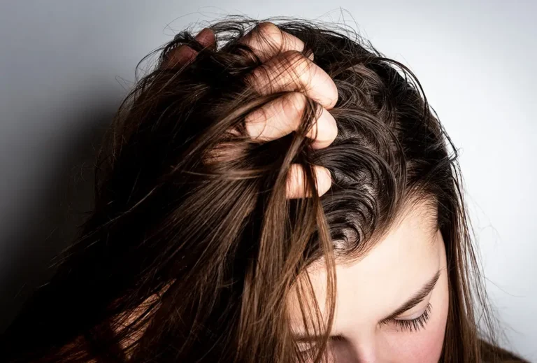 Мазна коса – Причини и начини да се справите с проблема