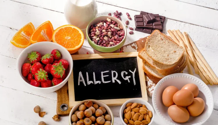 хранителни алергии