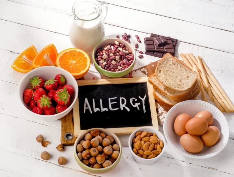 8-те най-често срещани хранителни алергии