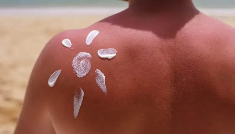 Как да спрете беленето на кожата при слънчево изгаряне