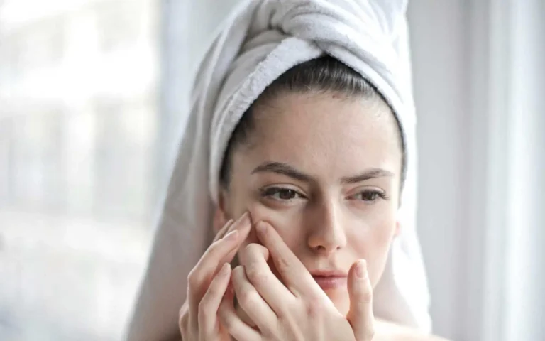 Какво причинява бели петна по лицето ми и как се лекуват?